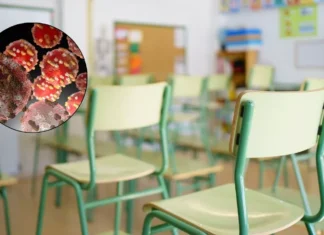 Suspenden clases en escuelas de Jalisco y Aguascalientes por sarampión