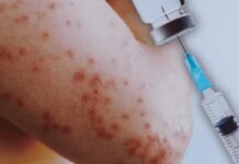 Ha aplicado IMSS 14 millones de vacunas contra el sarampión