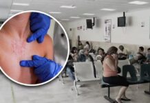 Aumenta a 31 cifra de muertes por sarampión; suman casi 10 mil casos acumulados