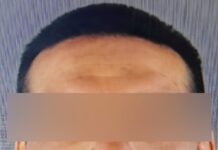 Obtiene FEM vinculación a proceso de imputado por delitos sexuales en Camargo