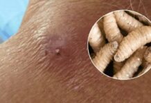 Yucatán registra primer fallecimiento por gusano barrenador