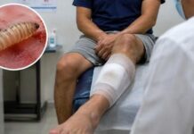 El gusano barrenador puede causar miasis en humanos